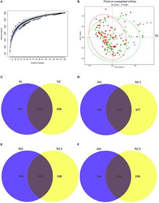 Combination effect between gut microbiota and traditional potentially modifiable risk factors for first-ever ischemic stroke in Tujia, Miao and Han populations in China